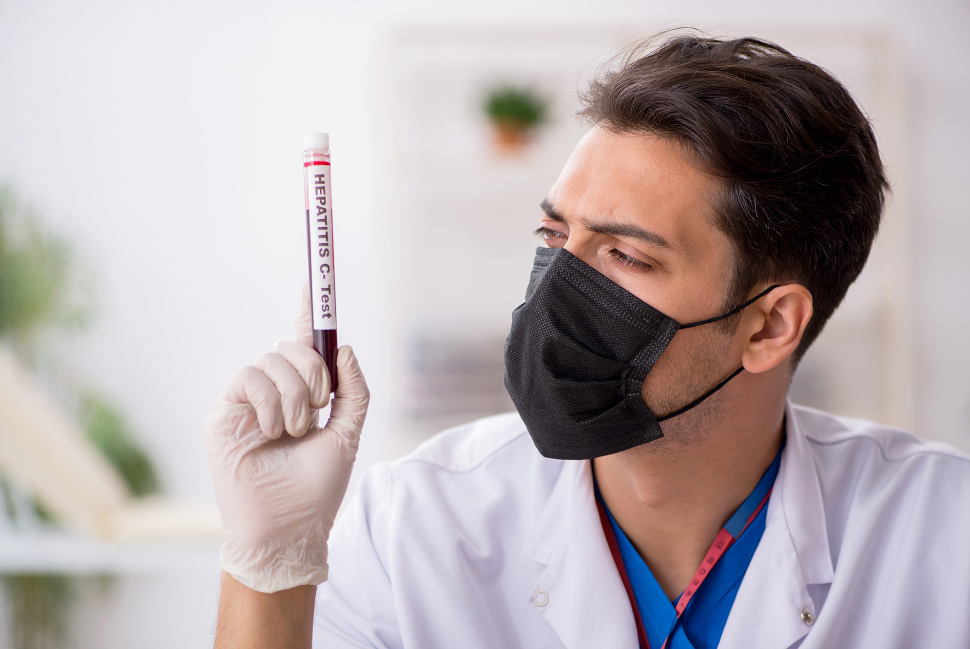 Doctor with hepatitis test